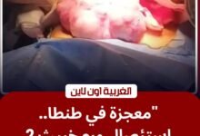 إنجاز طبي في الغربية.. استئصال ورم يزن 2 كجم بمستشفى سرطان الأطفال بجامعة طنطا
