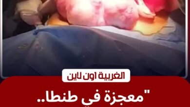 إنجاز طبي في الغربية.. استئصال ورم يزن 2 كجم بمستشفى سرطان الأطفال بجامعة طنطا