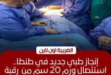 جراحة معقدة بمركز أورام طنطا لاستئصال ورم 20 سم من وجه ثلاثينية