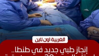 جراحة معقدة بمركز أورام طنطا لاستئصال ورم 20 سم من وجه ثلاثينية