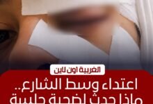 إصابة سيدة بجروح قطعية في اعتداء زوجها عليها بكفر الزيات