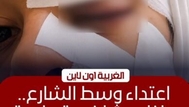 إصابة سيدة بجروح قطعية في اعتداء زوجها عليها بكفر الزيات