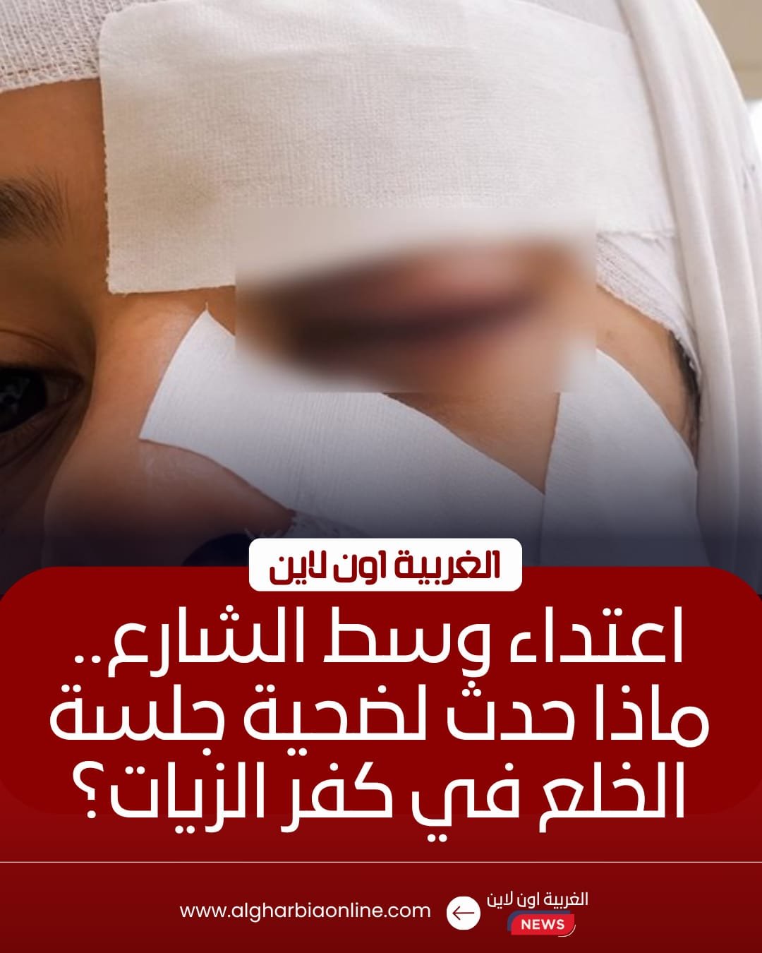 إصابة سيدة بجروح قطعية في اعتداء زوجها عليها بكفر الزيات