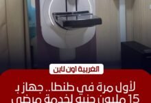 مركز أورام طنطا يطلق أحدث جهاز "ماموجرام" رقمي بـ 15 مليون جنيه